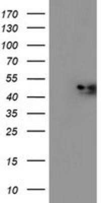 Western Blot: midA Antibody (OTI4A5)Azide and BSA Free [NBP2-72681]