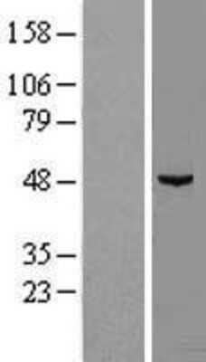 Western Blot: midA Overexpression Lysate [NBL1-08421]