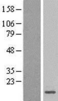 Western Blot: MRPL27 Overexpression Lysate [NBL1-13251]