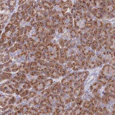 Immunohistochemistry-Paraffin: mitochondrial ribosomal protein L30 Antibody [NBP2-13614]