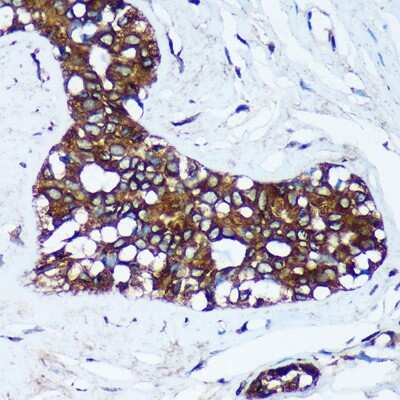Immunohistochemistry-Paraffin: mitochondrial ribosomal protein L30 Antibody - Azide and BSA Free [NBP3-03295]