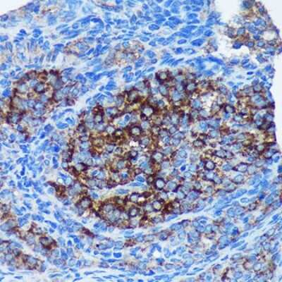 Immunohistochemistry-Paraffin: mitochondrial ribosomal protein L30 Antibody - Azide and BSA Free [NBP3-03295]