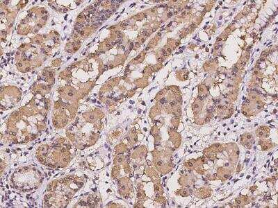 Immunohistochemistry-Paraffin: mitochondrial ribosomal protein L30 Antibody [NBP3-05921]