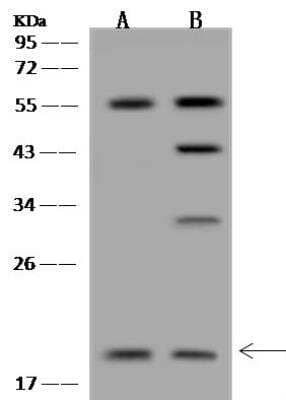 Western Blot: mitochondrial ribosomal protein L30 Antibody [NBP3-05921]