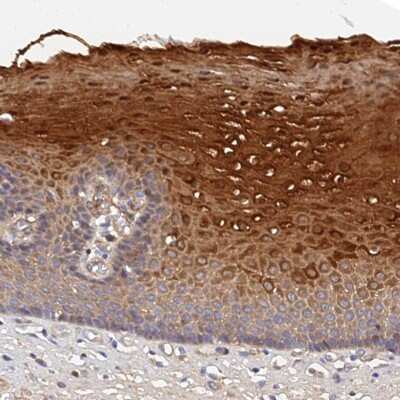 Immunohistochemistry-Paraffin: mitochondrial ribosomal protein L35 Antibody [NBP1-92119]