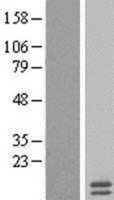 Western Blot: mitochondrial ribosomal protein L35 Overexpression Lysate [NBL1-13260]