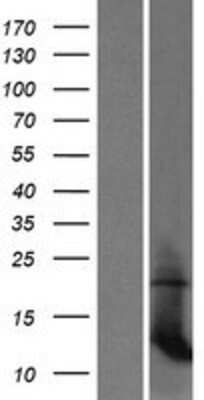 Western Blot: mitochondrial ribosomal protein L35 Overexpression Lysate [NBP2-07009]