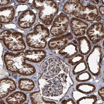 Immunohistochemistry-Paraffin: mitochondrial ribosomal protein L4 Antibody [NBP2-13617]