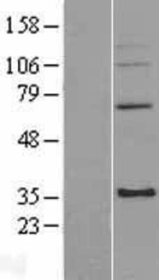 Western Blot: mitochondrial ribosomal protein L4 Overexpression Lysate [NBL1-13265]