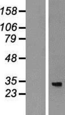 Western Blot: mitochondrial ribosomal protein L4 Overexpression Lysate [NBP2-11289]