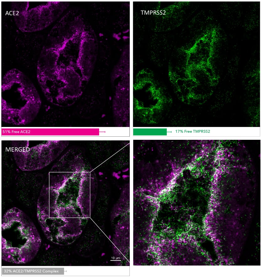 MolBoolean Mouse/Rabbit Assay Kit Proximity Ligation Assay: MolBoolean Mouse/Rabbit Assay Kit [Molb00001]