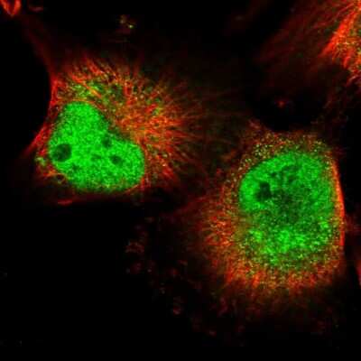 Immunocytochemistry/ Immunofluorescence: mpp8 Antibody [NBP1-92136]