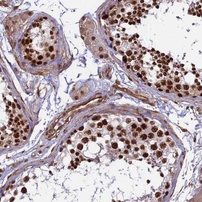Immunohistochemistry-Paraffin: mpp8 Antibody [NBP1-92135]