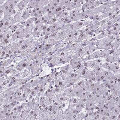 Immunohistochemistry-Paraffin: mpp8 Antibody [NBP1-92135]