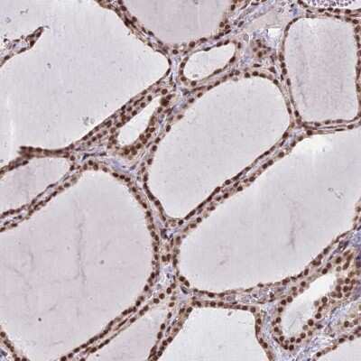 Immunohistochemistry-Paraffin: mpp8 Antibody [NBP1-92135]