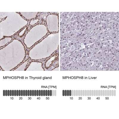 Immunohistochemistry-Paraffin: mpp8 Antibody [NBP1-92135]