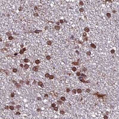 Immunohistochemistry-Paraffin: mpp8 Antibody [NBP1-92135]