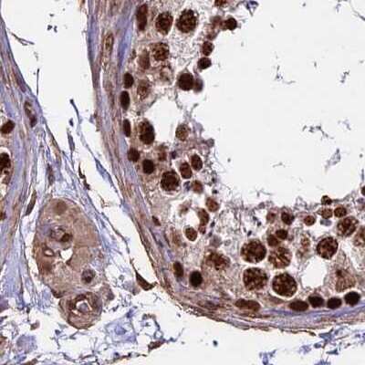Immunohistochemistry-Paraffin: mpp8 Antibody [NBP1-92135]
