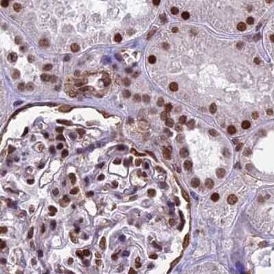 Immunohistochemistry-Paraffin: mpp8 Antibody [NBP1-92135]