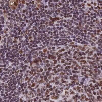 Immunohistochemistry-Paraffin: mpp8 Antibody [NBP1-92135]