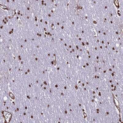 Immunohistochemistry-Paraffin: mpp8 Antibody [NBP1-92135]