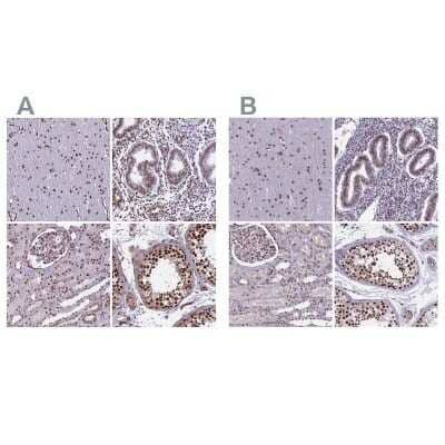 Immunohistochemistry-Paraffin: mpp8 Antibody [NBP1-92135]