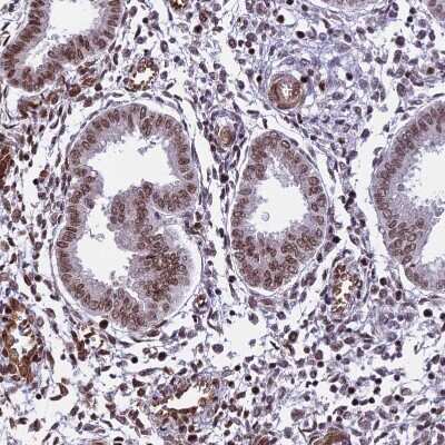 Immunohistochemistry-Paraffin: mpp8 Antibody [NBP1-92135]