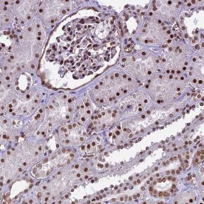Immunohistochemistry-Paraffin: mpp8 Antibody [NBP1-92135]