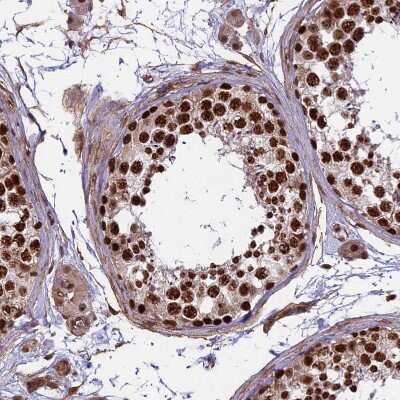 Immunohistochemistry-Paraffin: mpp8 Antibody [NBP1-92135]