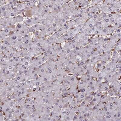 Immunohistochemistry-Paraffin: mpp8 Antibody [NBP1-92136]