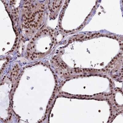 Immunohistochemistry-Paraffin: mpp8 Antibody [NBP1-92136]