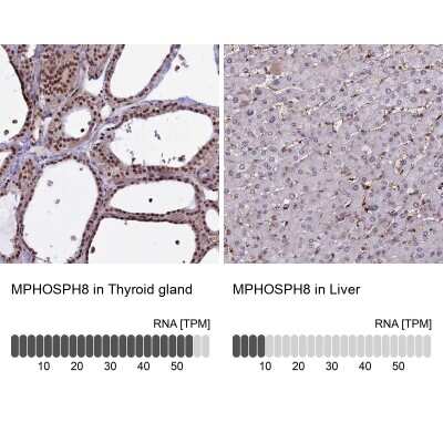Immunohistochemistry-Paraffin: mpp8 Antibody [NBP1-92136]