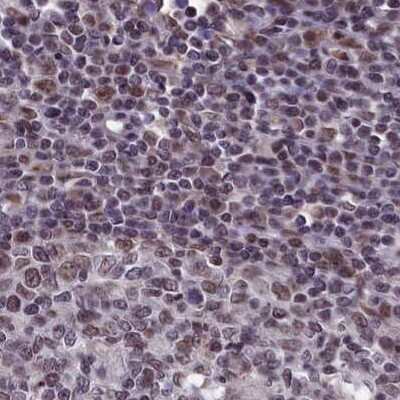 Immunohistochemistry-Paraffin: mpp8 Antibody [NBP1-92136]