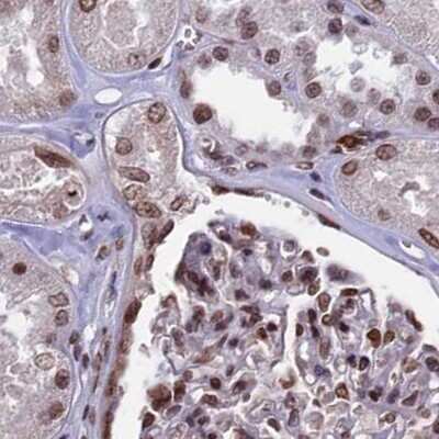 Immunohistochemistry-Paraffin: mpp8 Antibody [NBP1-92136]