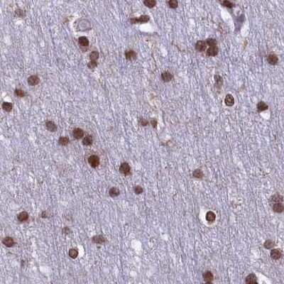 Immunohistochemistry-Paraffin: mpp8 Antibody [NBP1-92136]