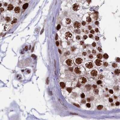 Immunohistochemistry-Paraffin: mpp8 Antibody [NBP1-92136]