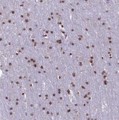 Immunohistochemistry-Paraffin: mpp8 Antibody [NBP1-92136]