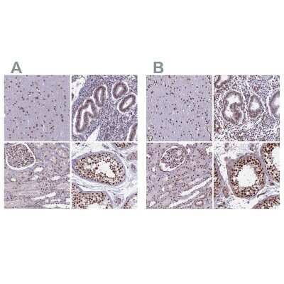 Immunohistochemistry-Paraffin: mpp8 Antibody [NBP1-92136]