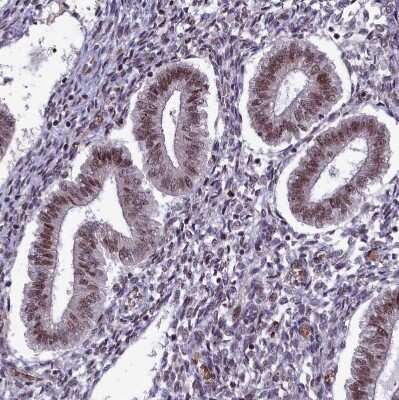 Immunohistochemistry-Paraffin: mpp8 Antibody [NBP1-92136]