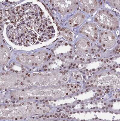 Immunohistochemistry-Paraffin: mpp8 Antibody [NBP1-92136]