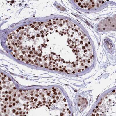 Immunohistochemistry-Paraffin: mpp8 Antibody [NBP1-92136]