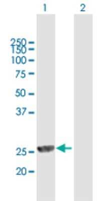 Western Blot: mpp8 Antibody [H00054737-B01P]