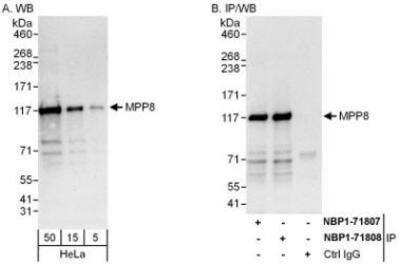 Western Blot: mpp8 Antibody [NBP1-71808]