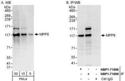 Western Blot: mpp8 Antibody [NBP1-71809]