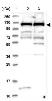 Western Blot: mpp8 Antibody [NBP1-92135]