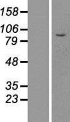 Western Blot: mpp8 Overexpression Lysate [NBL1-13199]