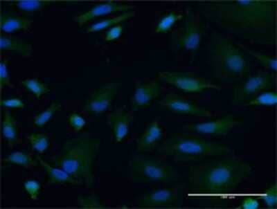 Immunocytochemistry/ Immunofluorescence: mtRNA polymerase Antibody (3D9) [H00005442-M01]