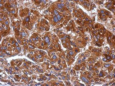 Immunohistochemistry-Paraffin: mtRNA polymerase Antibody [NBP2-19436]