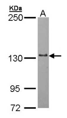 Western Blot: mtRNA polymerase Antibody [NBP2-19436]