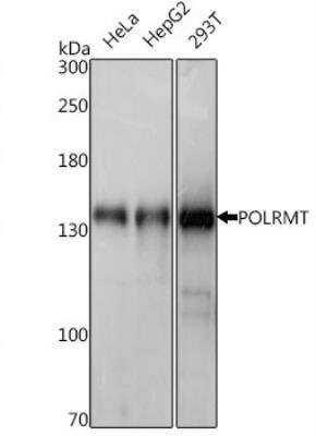 Western Blot: mtRNA polymerase Antibody [NBP2-95264]